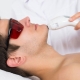 Épilation faciale au laser pour hommes